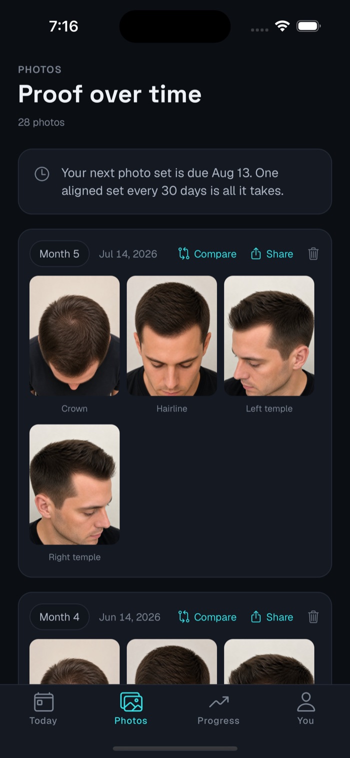 HairAgain photo library showing aligned monthly sets by angle